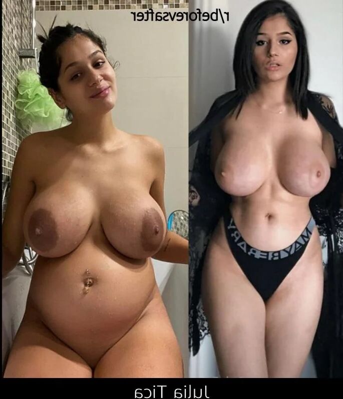 Reddit collection after and before pregnancy 2