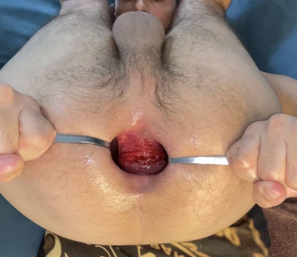 Gape anal