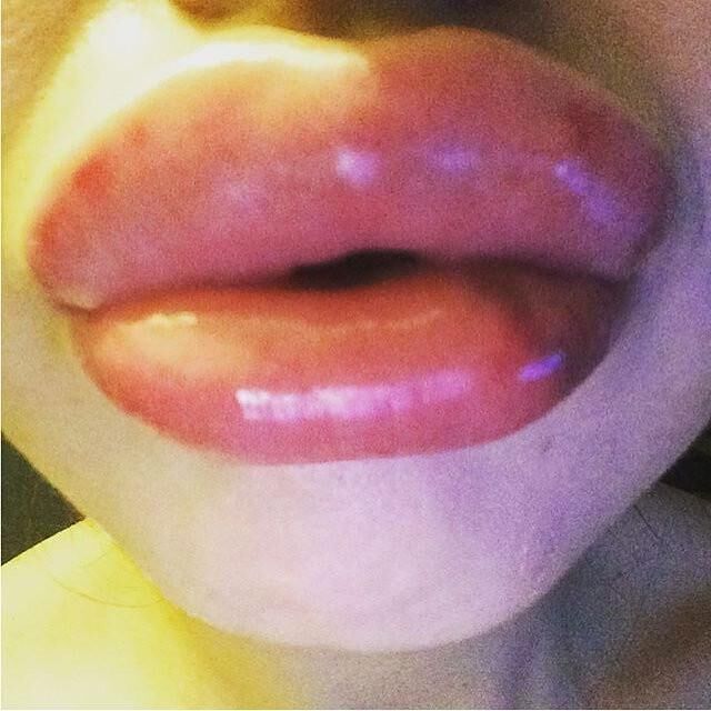 lips