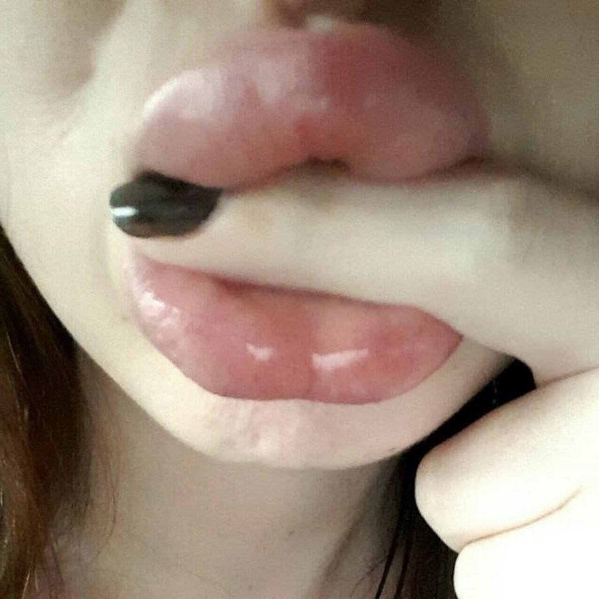 lips