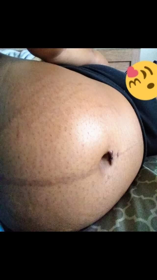 pregnant bikini and belly pics Nov 2023