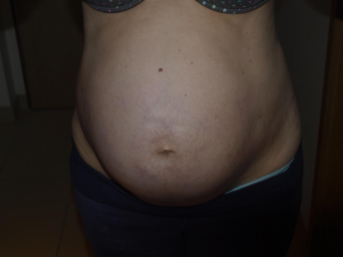 Mujer [embarazada] muestra su barriga