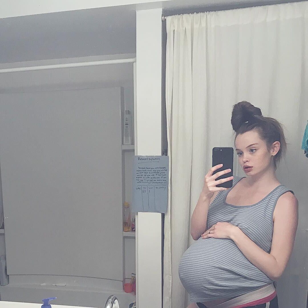 [Pregnant] young girl with twins