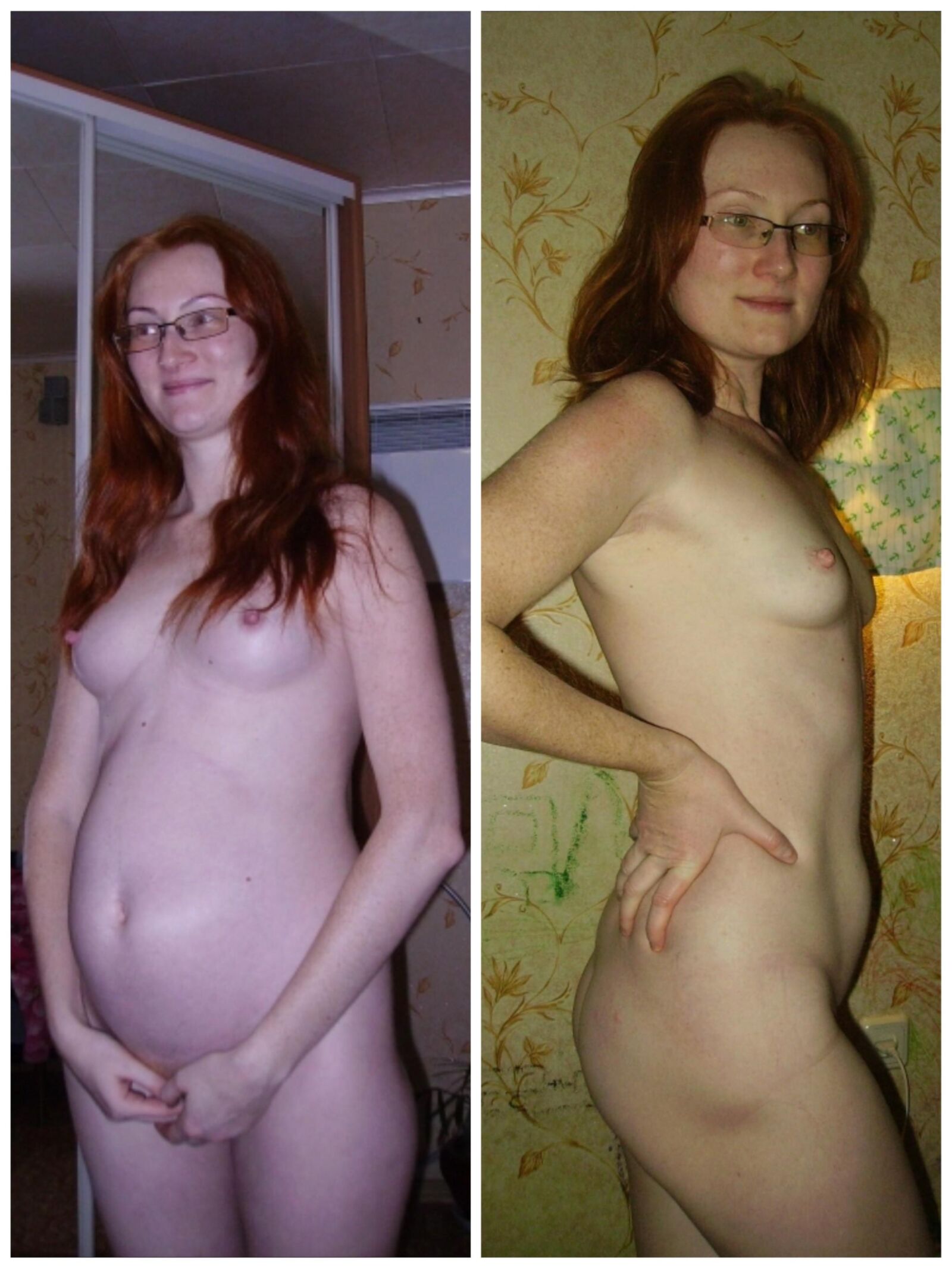 Before n after mix pregnant