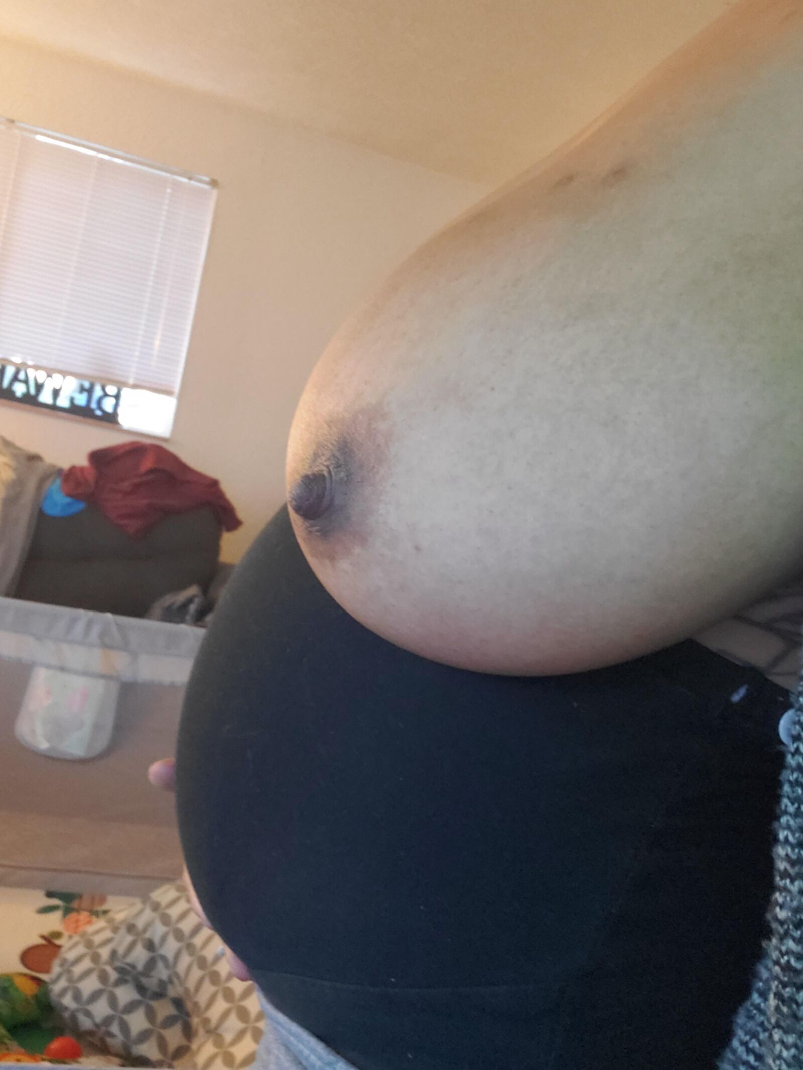 Pregnant native with huge inverted nipple 