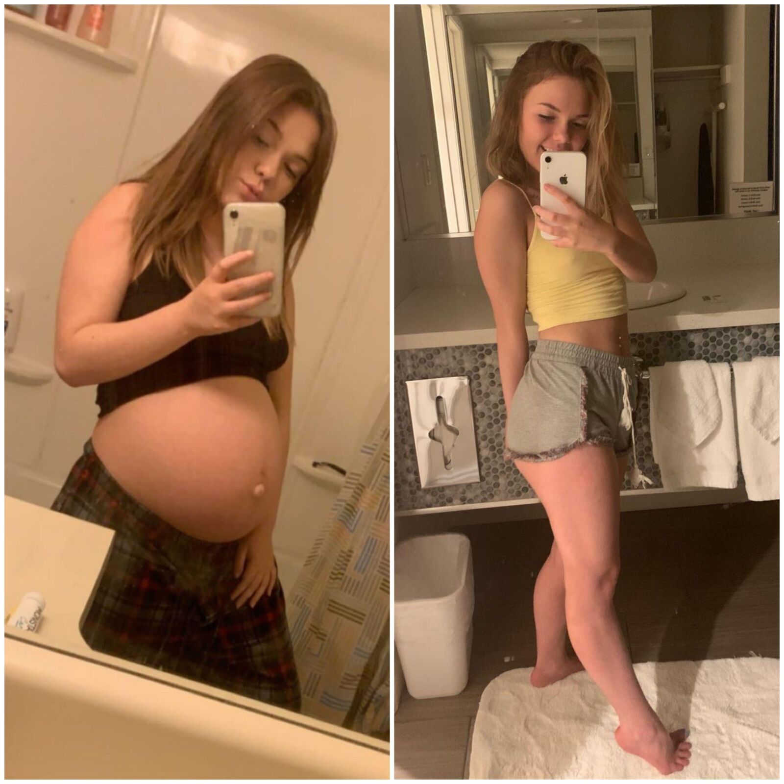 Pregnant teens - before and after 3