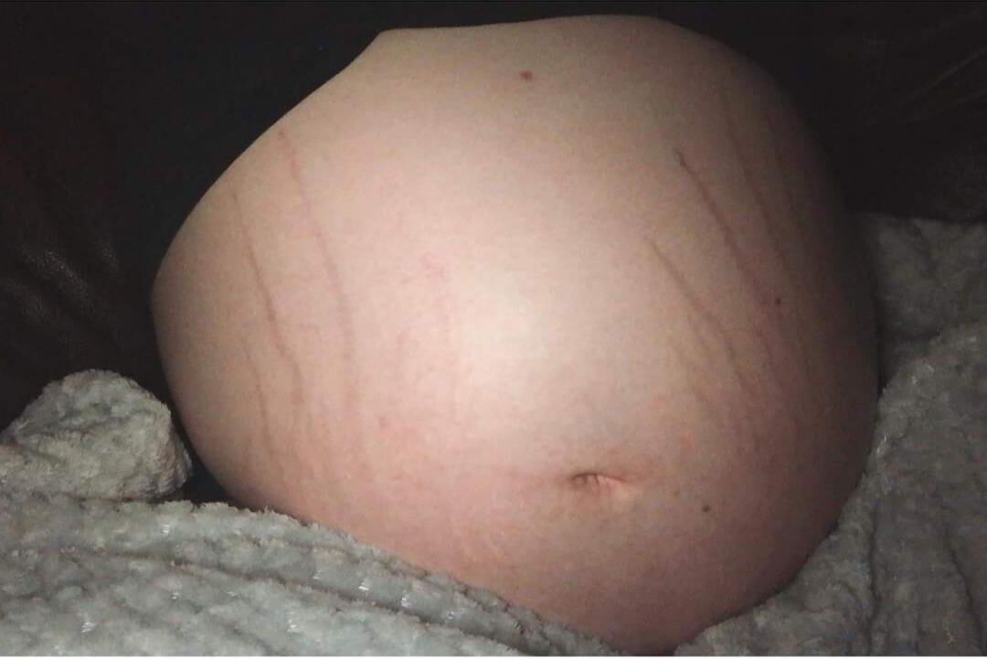 Pregnant Woman 38