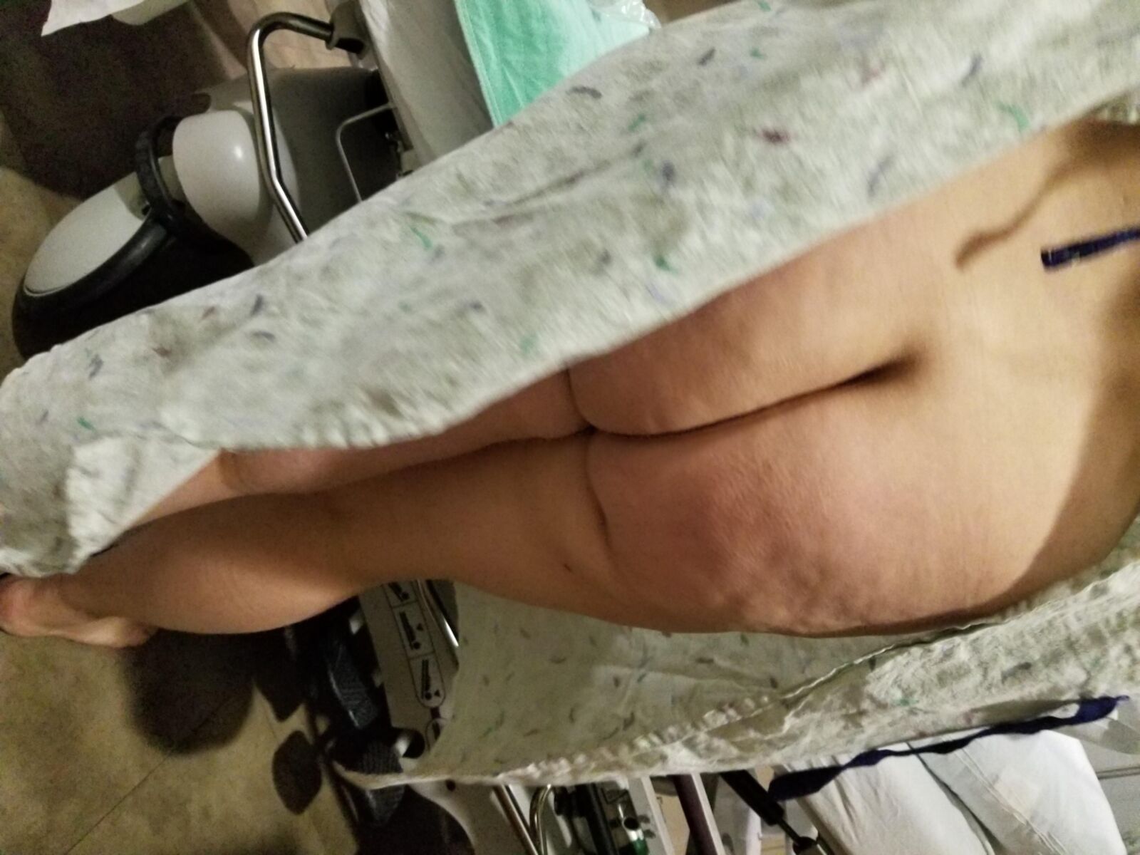 Girlfriend's Bare Ass in Hospital Gown