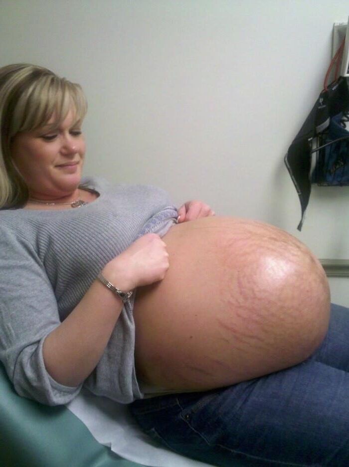 mature preggos 