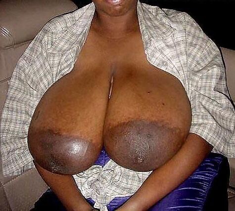 Massive dark areolas