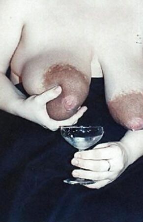 Massive dark areolas