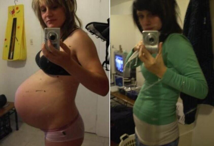 Pregnant - Before and After 3