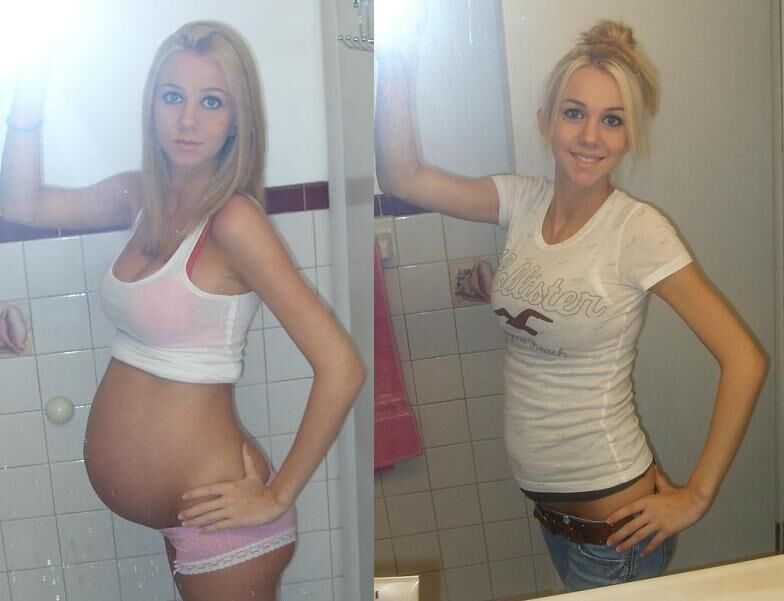 Pregnant - Before and After 1