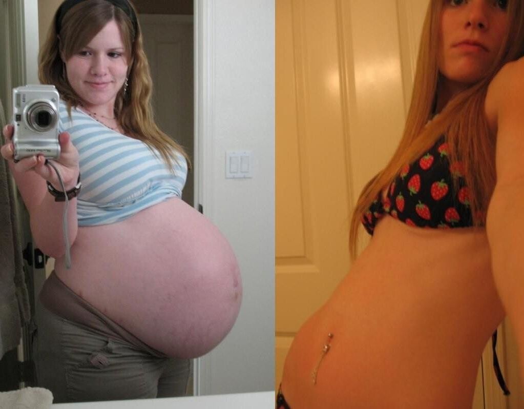 Pregnant - Before and After 3