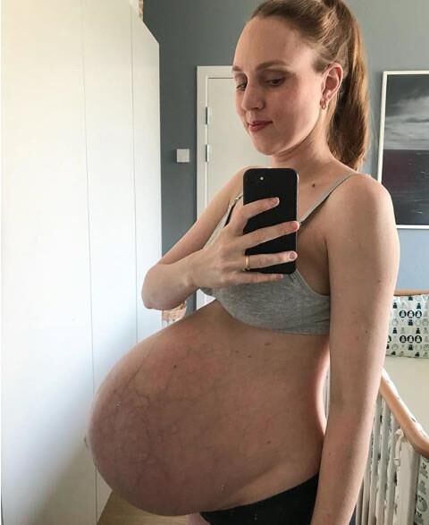 Triplets on the Way
