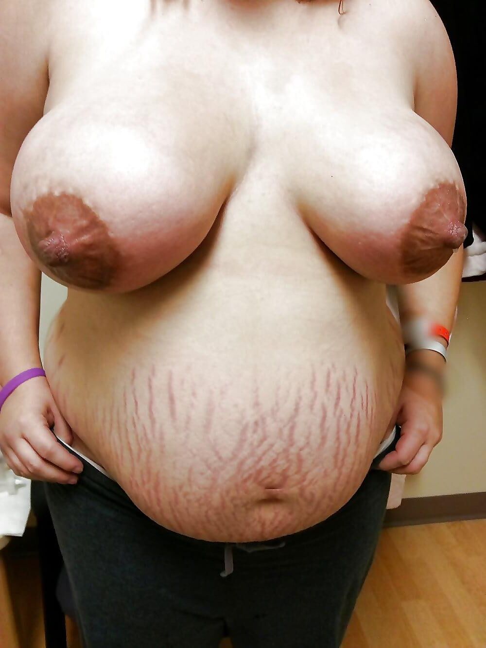 Pregnant Mix 